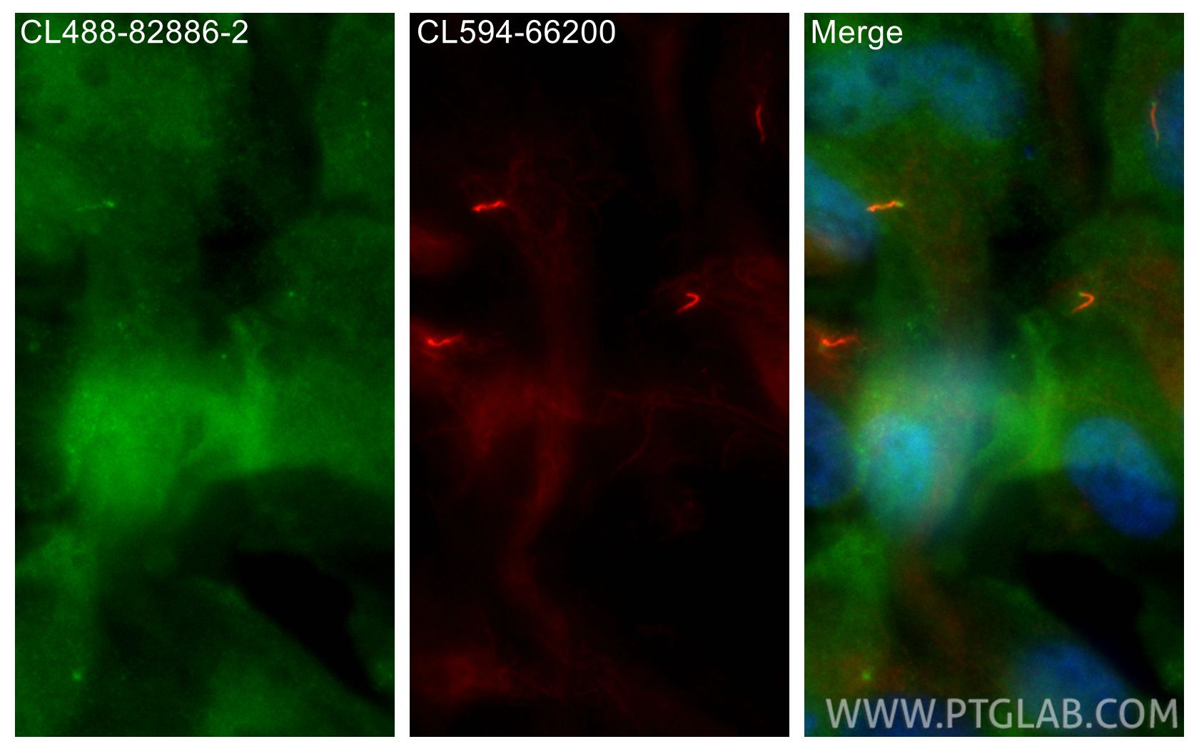 Immunofluorescence (IF) / fluorescent staining of hTERT-RPE1 cells using CoraLite® Plus 488-conjugated IFT88 Recombinant mo (CL488-82886-2)