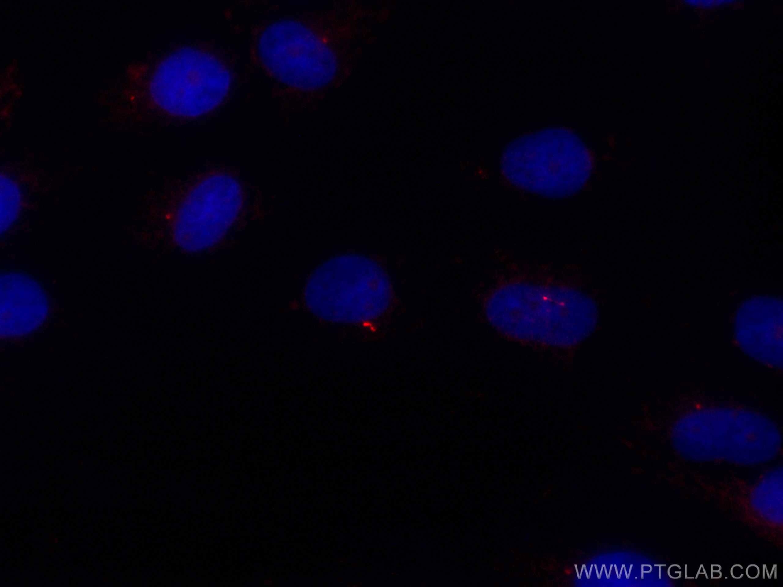 Immunofluorescence (IF) / fluorescent staining of MDCK cells using CoraLite®594-conjugated IFT88 Polyclonal antibody (CL594-13967)