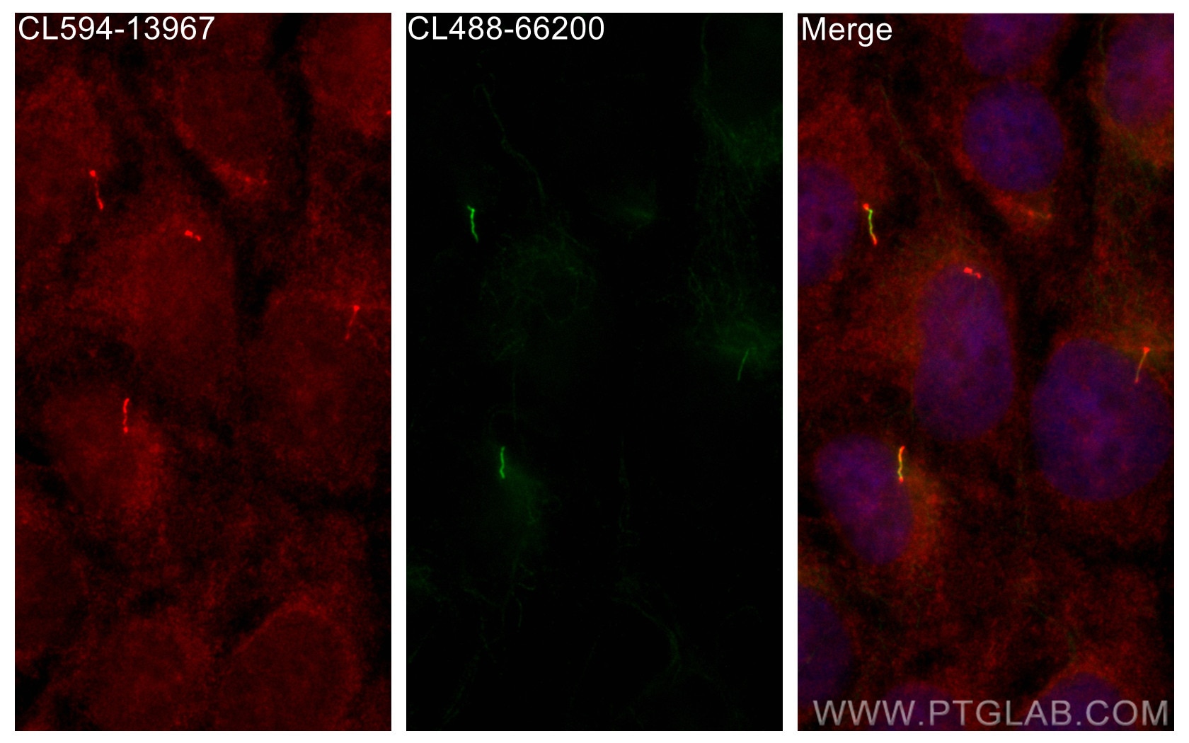 Immunofluorescence (IF) / fluorescent staining of hTERT-RPE1 cells using CoraLite®594-conjugated IFT88 Polyclonal antibody (CL594-13967)