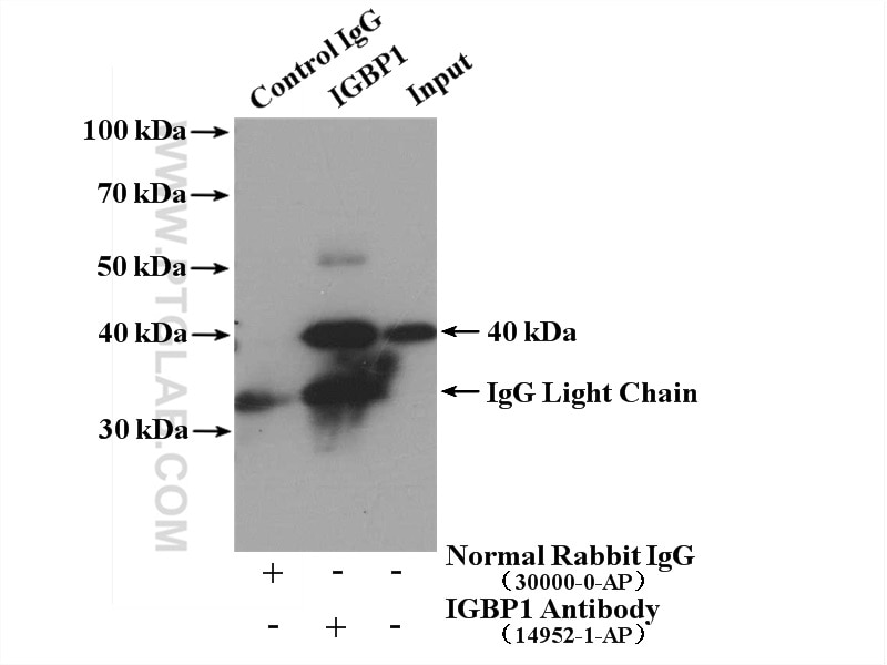 Immunoprecipitation (IP) experiment of Jurkat cells using IGBP1 Polyclonal antibody (14952-1-AP)