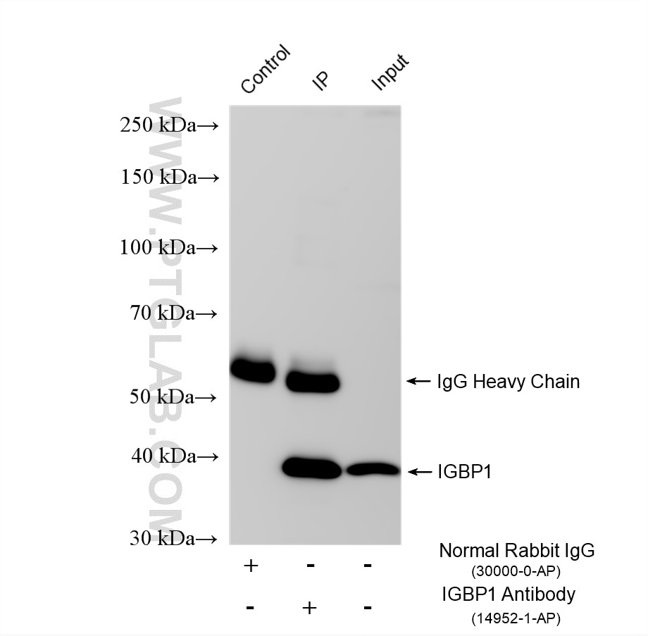 Immunoprecipitation (IP) experiment of Jurkat cells using IGBP1 Polyclonal antibody (14952-1-AP)