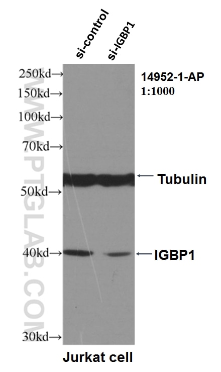 Western Blot (WB) analysis of Jurkat cells using IGBP1 Polyclonal antibody (14952-1-AP)