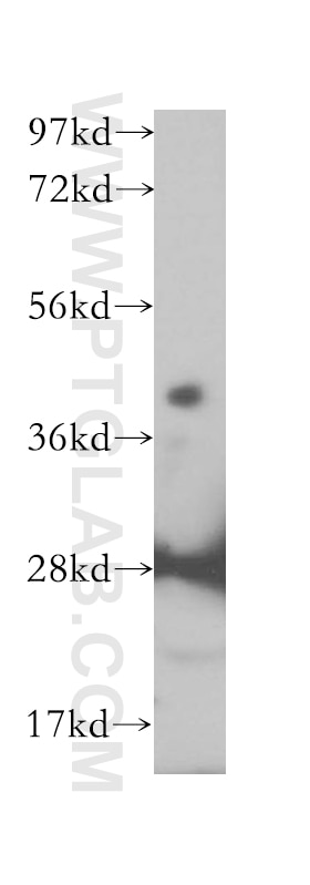 Western Blot (WB) analysis of Jurkat cells using IGBP1 Polyclonal antibody (14952-1-AP)