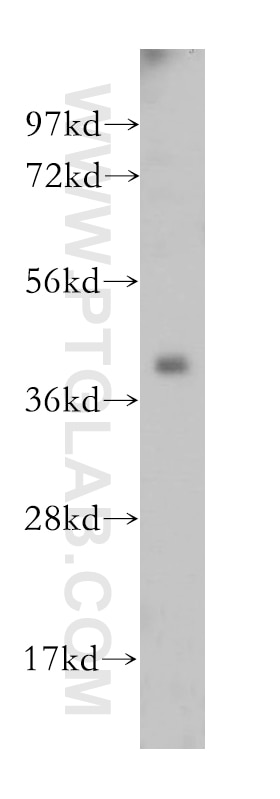 Western Blot (WB) analysis of HeLa cells using IGBP1 Polyclonal antibody (14952-1-AP)