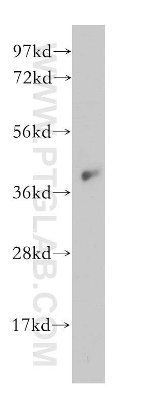 Western Blot (WB) analysis of MCF-7 cells using IGBP1 Polyclonal antibody (14952-1-AP)