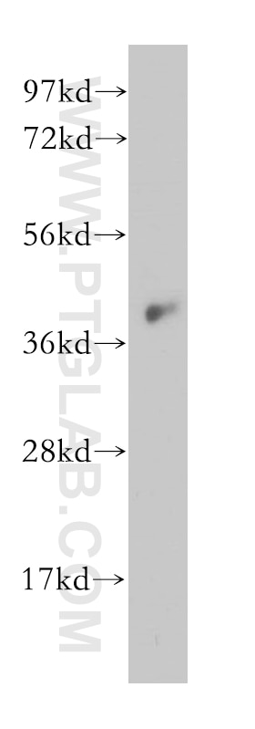 WB analysis of MCF-7 using 14952-1-AP