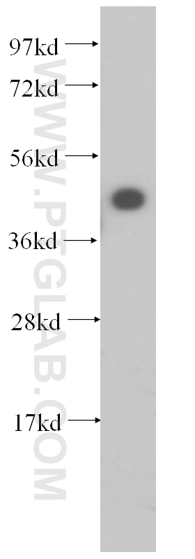 Western Blot (WB) analysis of Raji cells using IGBP1 Polyclonal antibody (14952-1-AP)