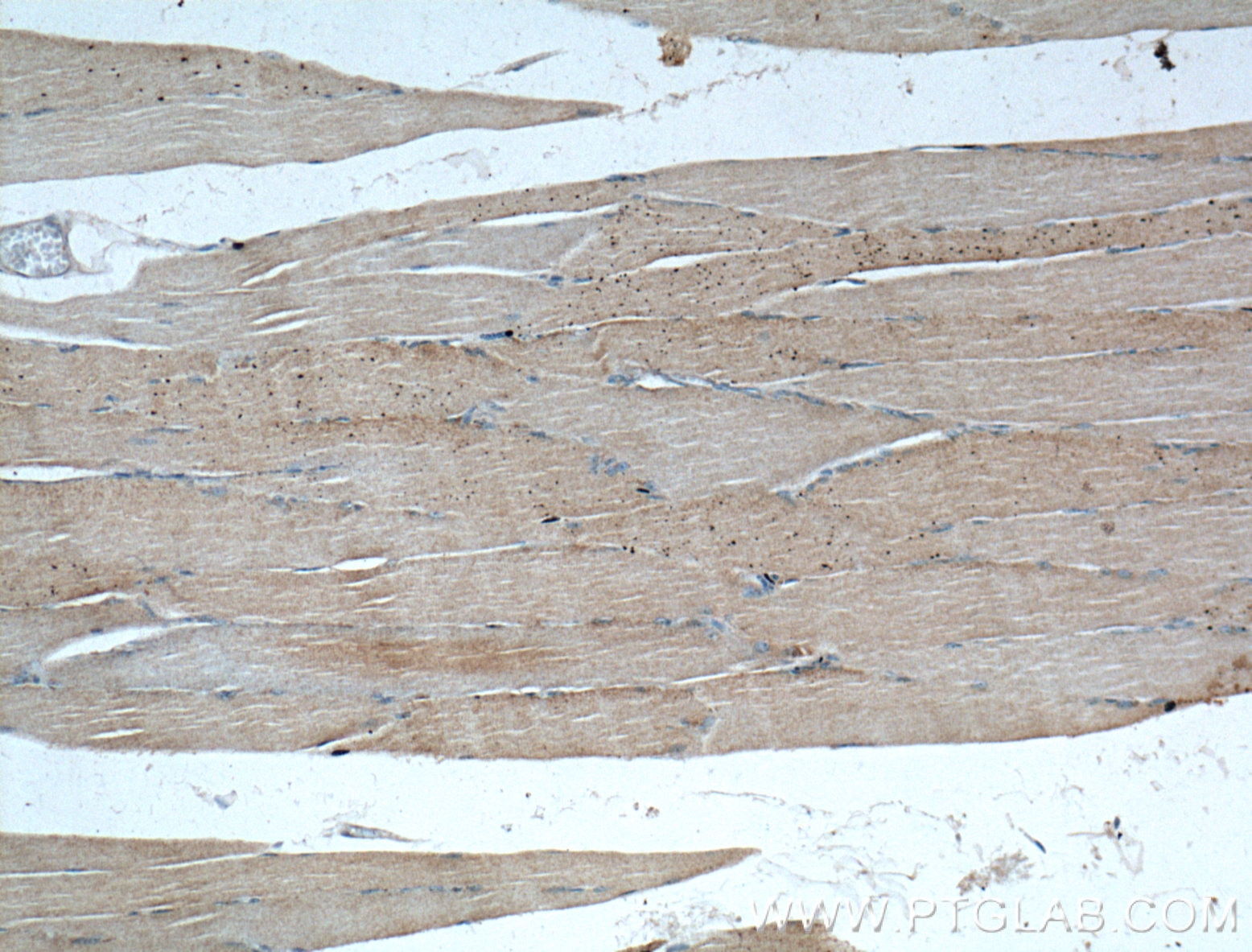 IHC staining of human skeletal muscle using 60256-1-Ig