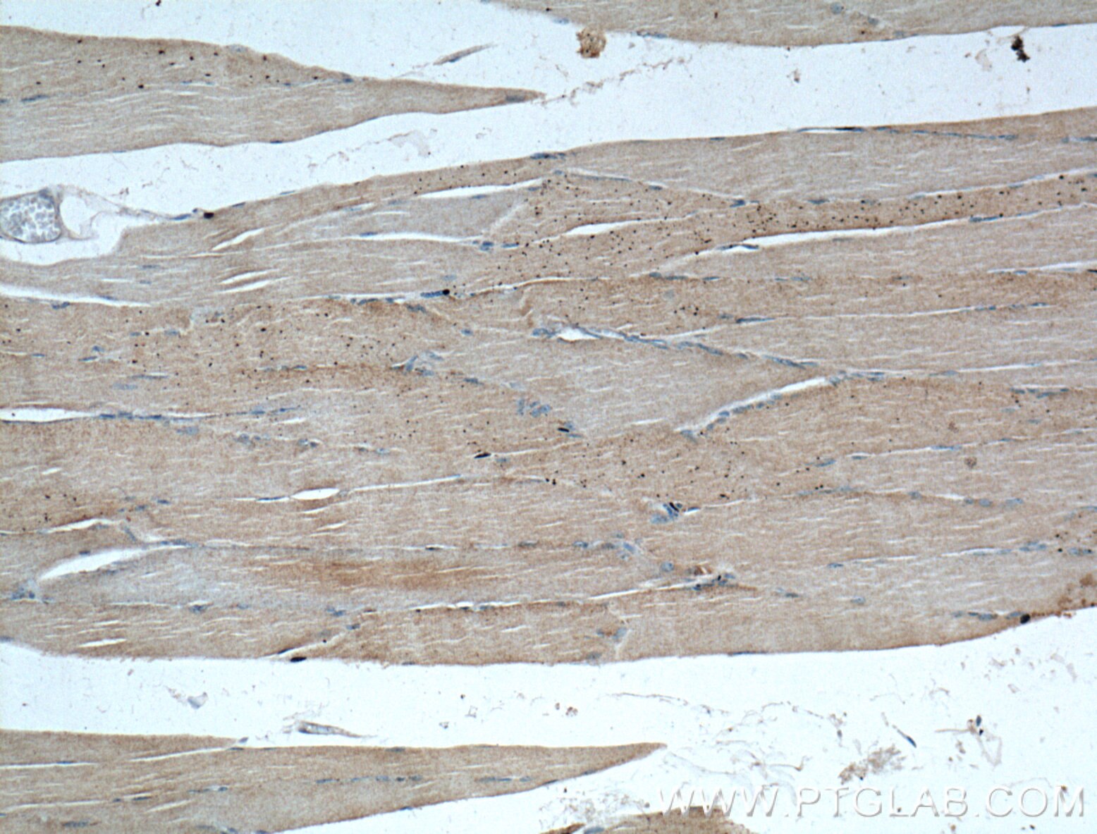 Immunohistochemistry (IHC) staining of human skeletal muscle tissue using IGBP1 Monoclonal antibody (60256-1-Ig)