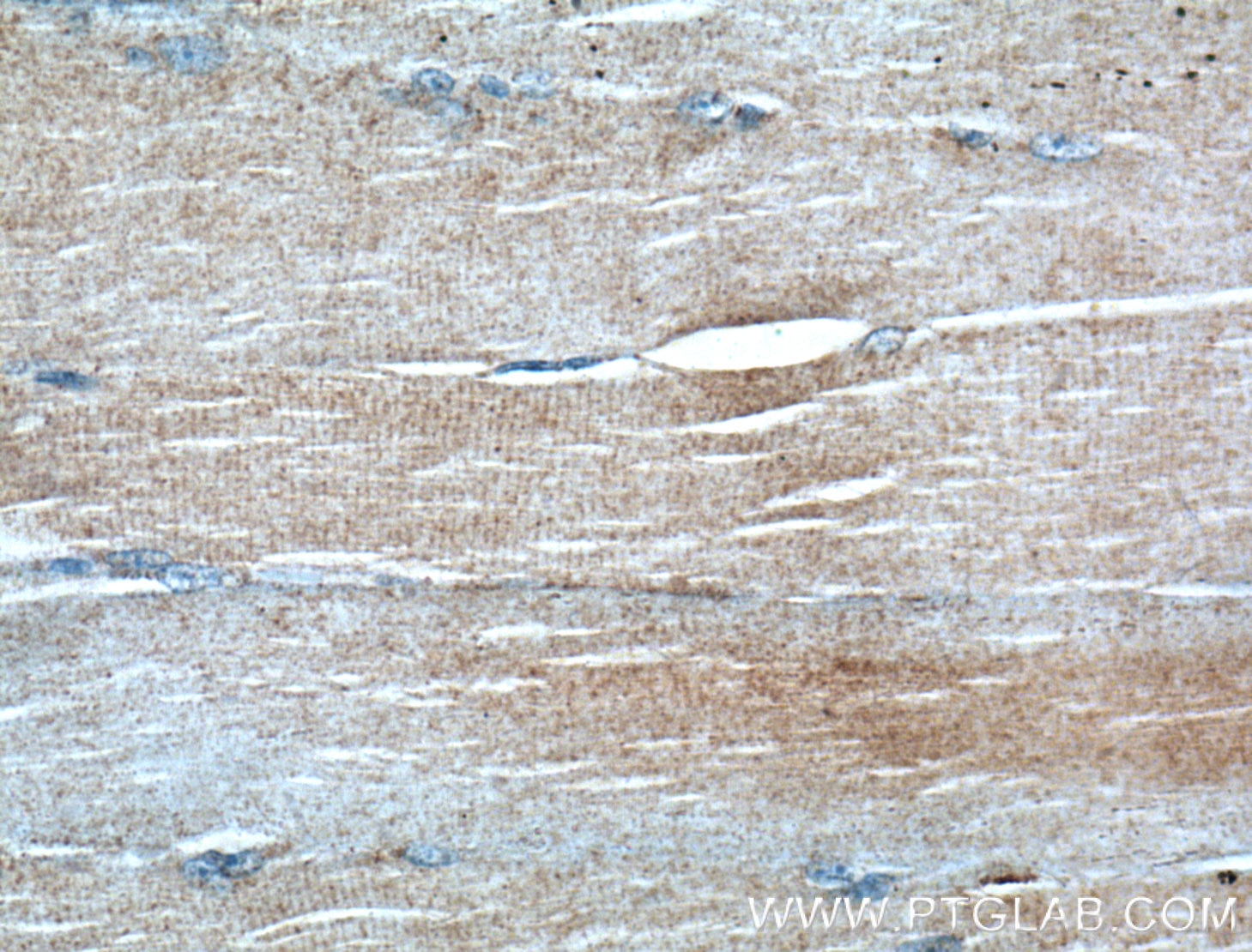 IHC staining of human skeletal muscle using 60256-1-Ig