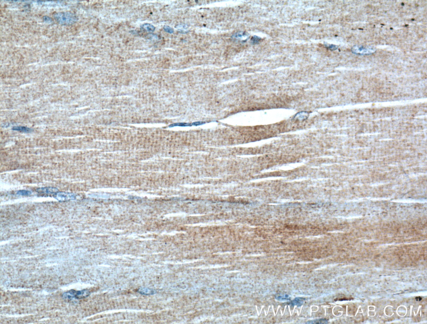 Immunohistochemistry (IHC) staining of human skeletal muscle tissue using IGBP1 Monoclonal antibody (60256-1-Ig)