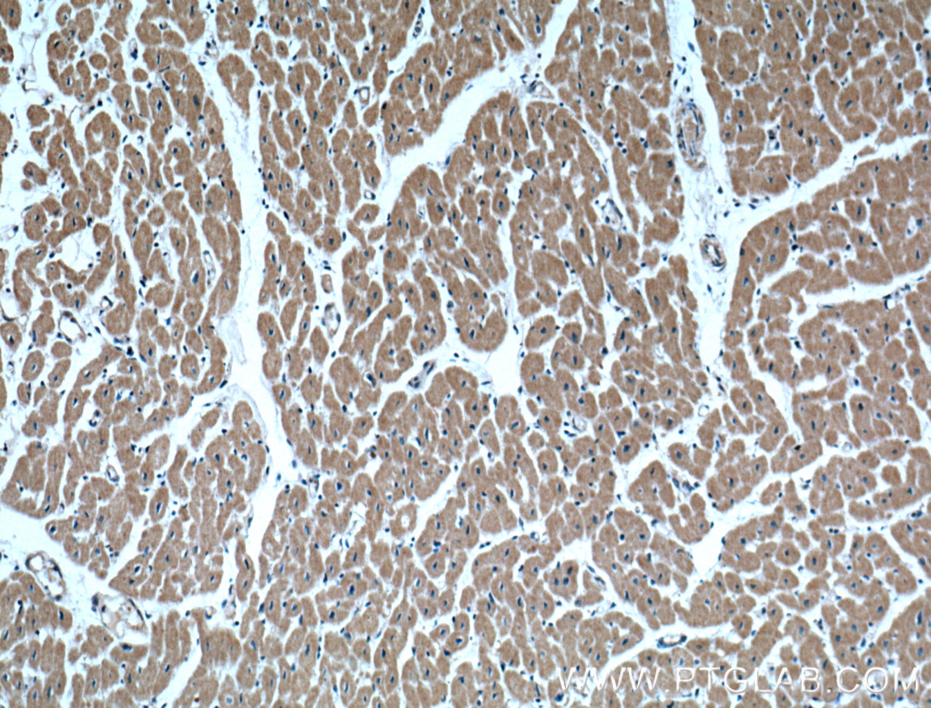 Immunohistochemistry (IHC) staining of human heart tissue using IGBP1 Monoclonal antibody (60256-1-Ig)