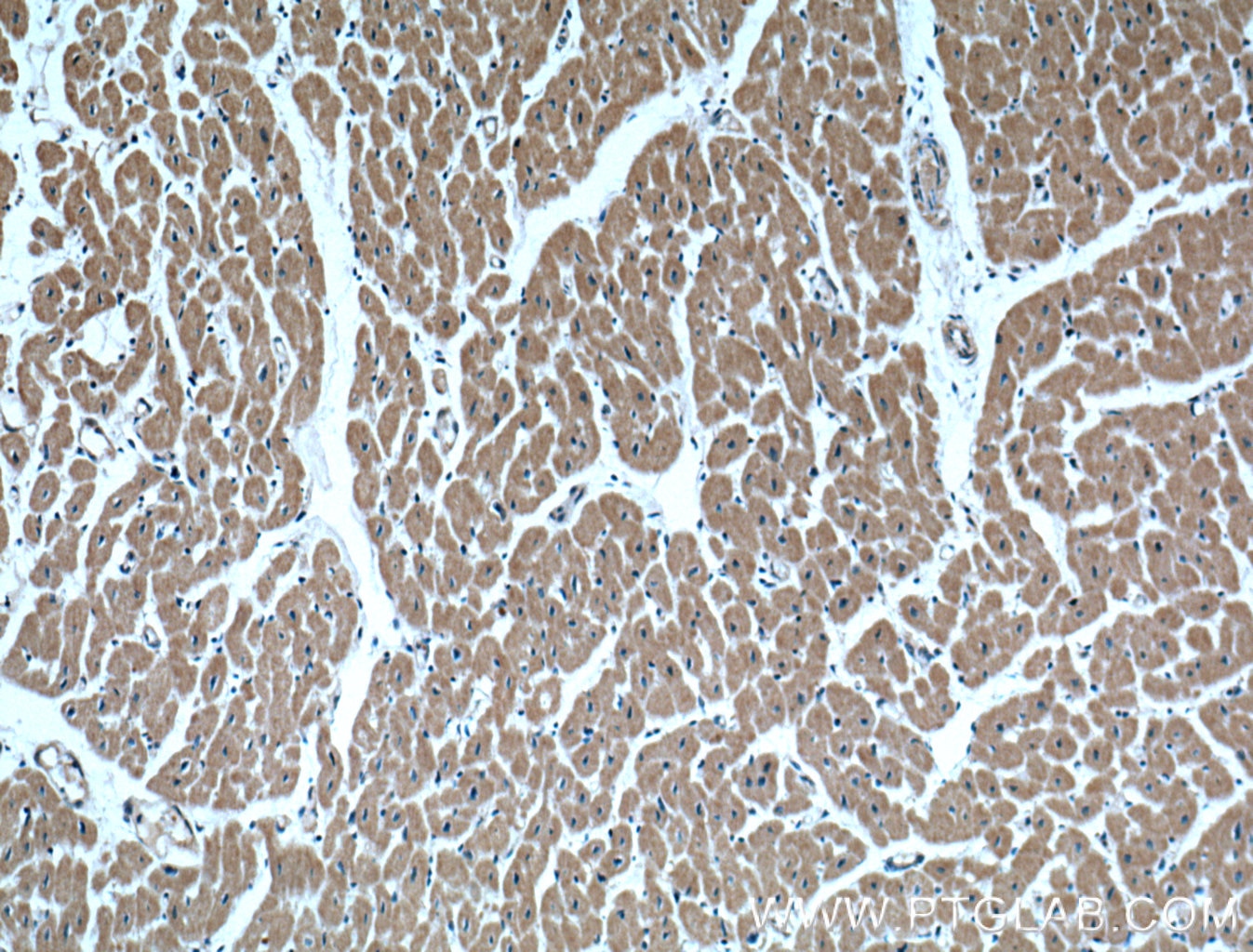 IHC staining of human heart using 60256-1-Ig