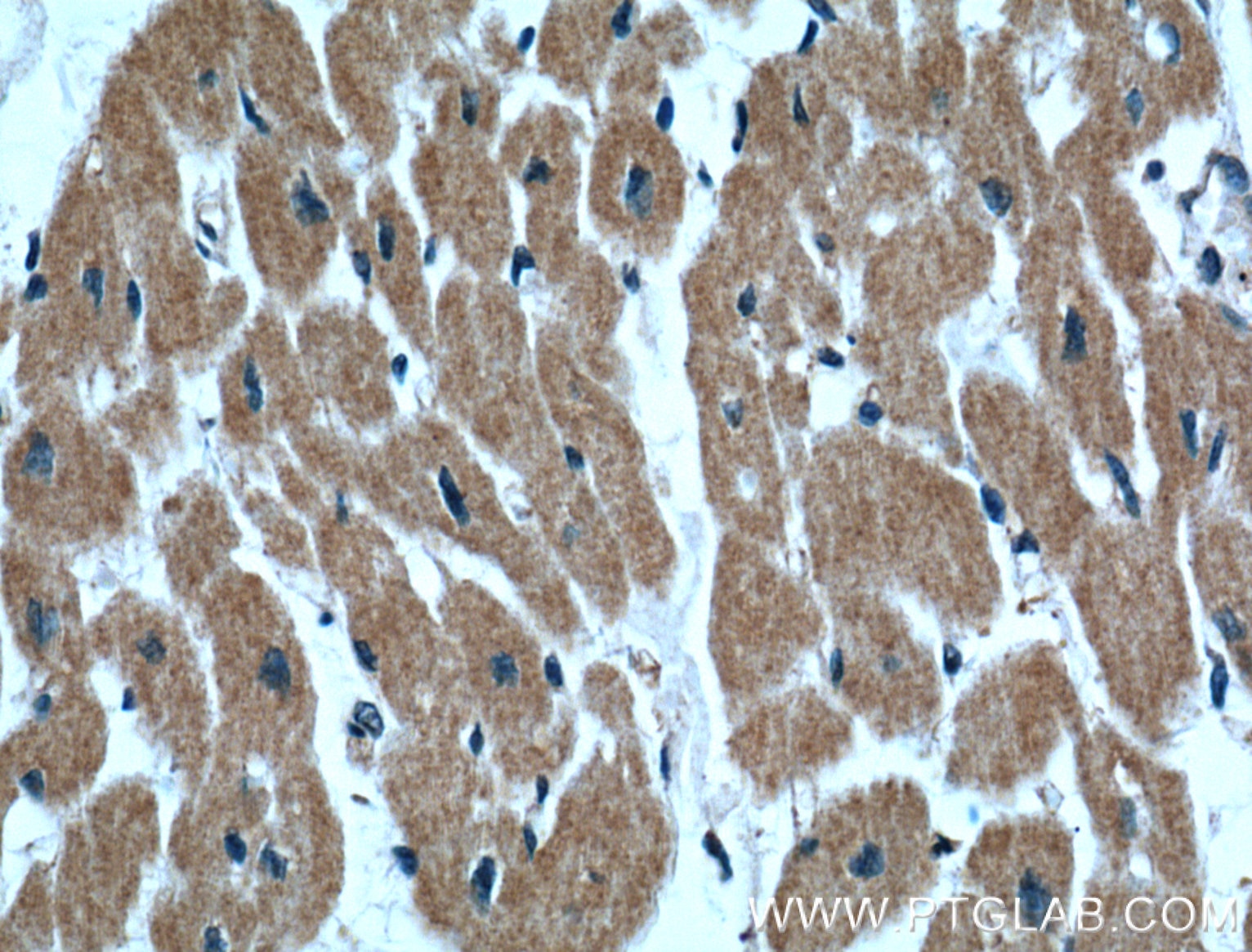 Immunohistochemistry (IHC) staining of human heart tissue using IGBP1 Monoclonal antibody (60256-1-Ig)