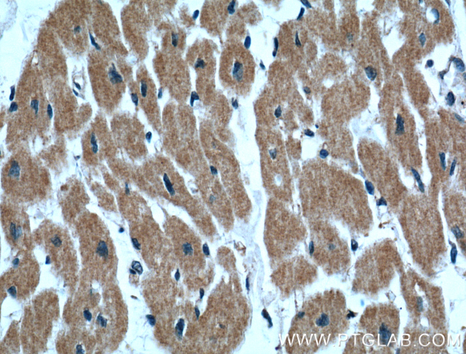 IHC staining of human heart using 60256-1-Ig