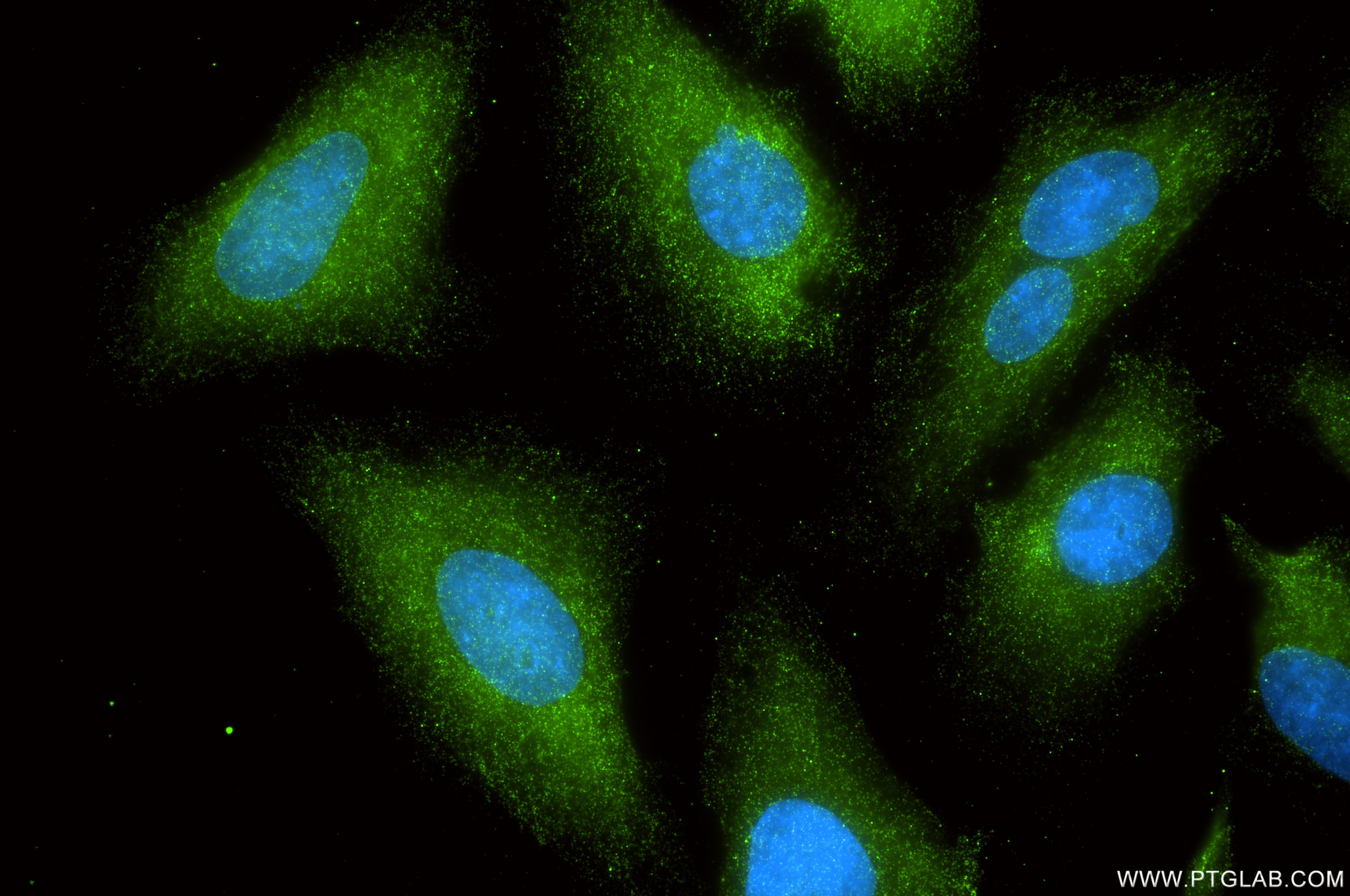 IF Staining of HeLa using 87726-1-RR Immunofluorescence (IF) / fluorescent staining of HeLa cells using IGBP1 Recombinant monoclonal antibody (87726-1-RR)
