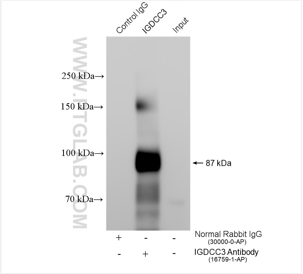 Immunoprecipitation (IP) experiment of human placenta tissue using IGDCC3 Polyclonal antibody (16759-1-AP)