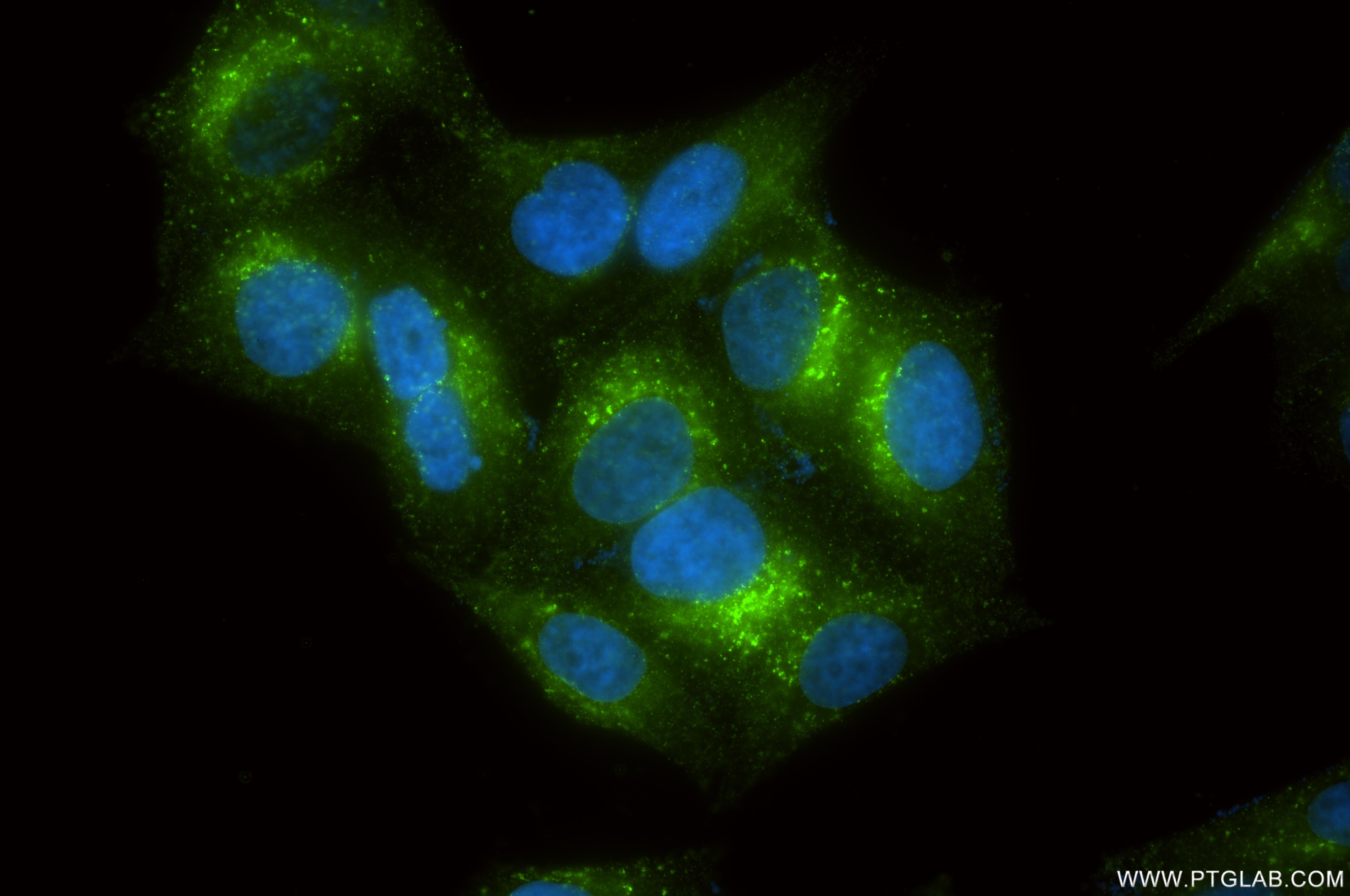 Immunofluorescence (IF) / fluorescent staining of HepG2 cells using IGF-II R/IGF2R Recombinant monoclonal antibody (86821-1-RR)