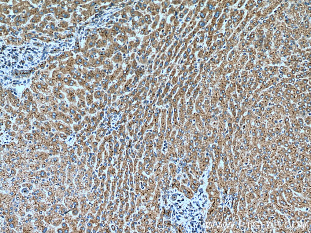 Immunohistochemistry (IHC) staining of human liver tissue using IGF1 Polyclonal antibody (28530-1-AP)