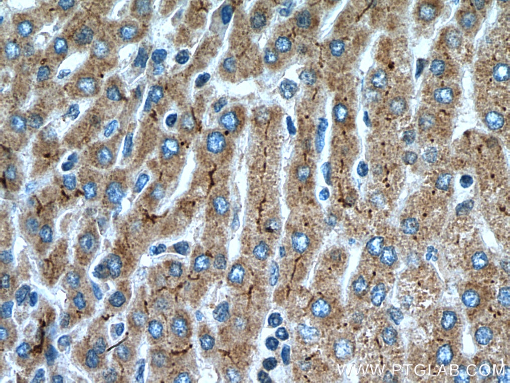 IHC staining of human liver using 28530-1-AP