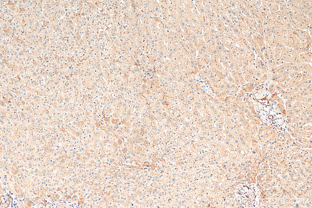 Immunohistochemistry (IHC) staining of human liver tissue using IGF1 Polyclonal antibody (28530-1-AP)