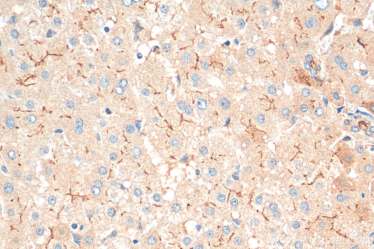 Immunohistochemistry (IHC) staining of human liver tissue using IGF1 Polyclonal antibody (28530-1-AP)