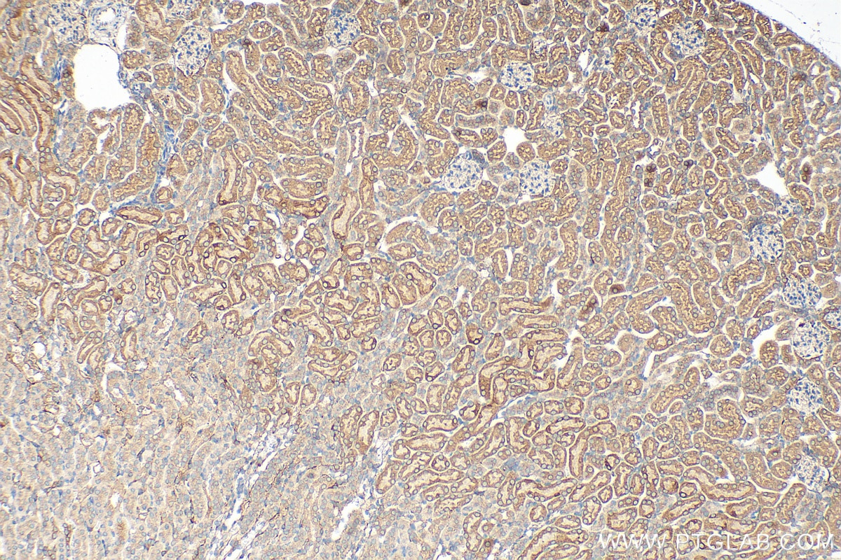 Immunohistochemistry (IHC) staining of mouse kidney tissue using IGF1 Polyclonal antibody (28530-1-AP)