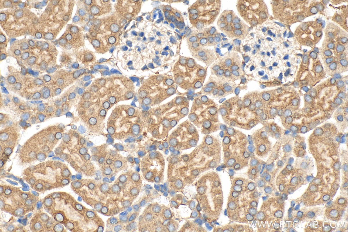 Immunohistochemistry (IHC) staining of mouse kidney tissue using IGF1 Polyclonal antibody (28530-1-AP)