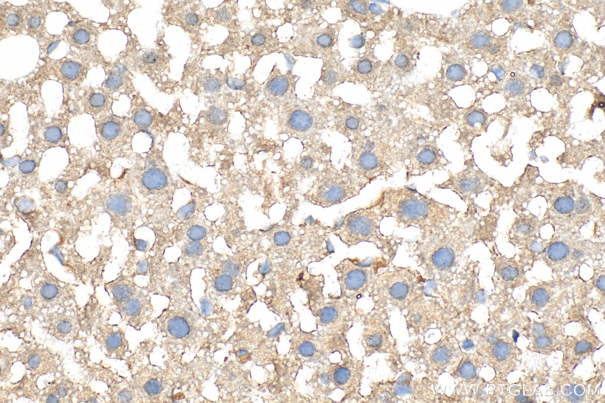 Immunohistochemistry (IHC) staining of mouse liver tissue using IGF1 Polyclonal antibody (28530-1-AP)