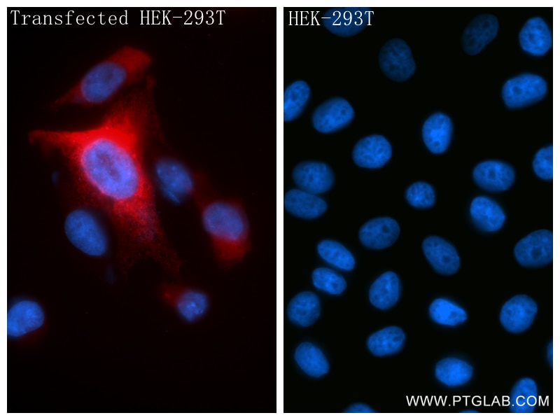 Immunofluorescence (IF) / fluorescent staining of Transfected HEK-293T cells using IGF1 Recombinant monoclonal antibody (84782-5-RR)