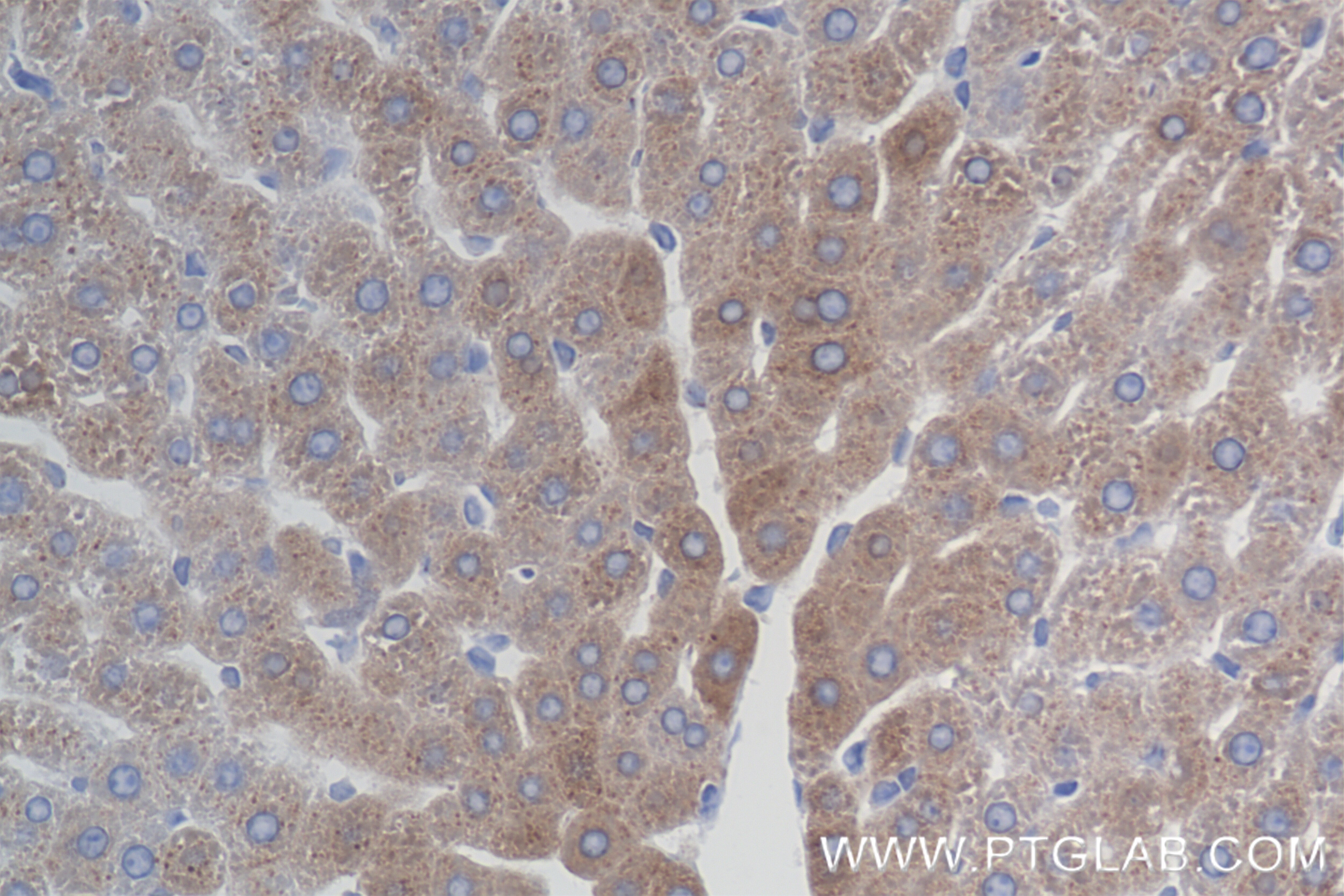 Immunohistochemistry (IHC) staining of rat liver tissue using IGF1 Recombinant antibody (84782-5-RR)