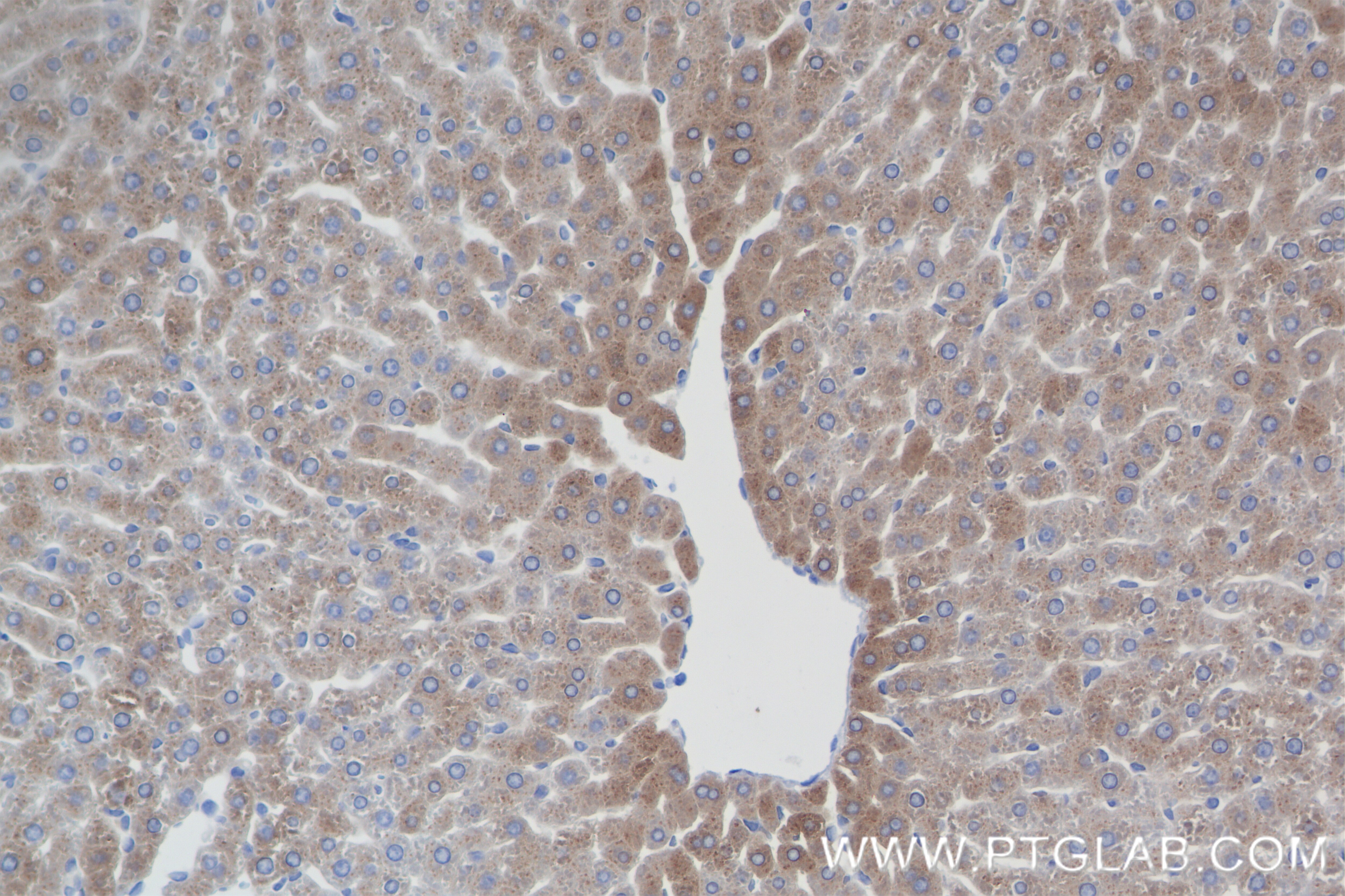 Immunohistochemistry (IHC) staining of rat liver tissue using IGF1 Recombinant antibody (84782-5-RR)