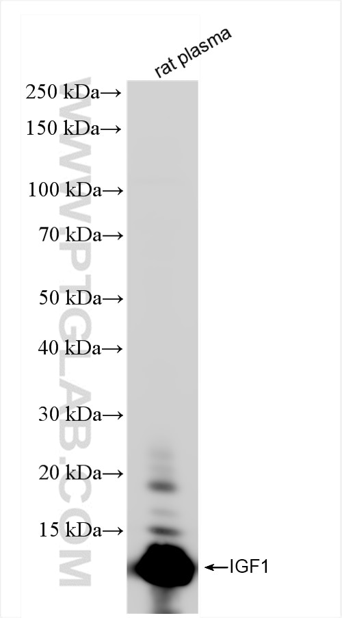 Western Blot (WB) analysis of rat plasma using IGF1 Recombinant antibody (84782-5-RR)