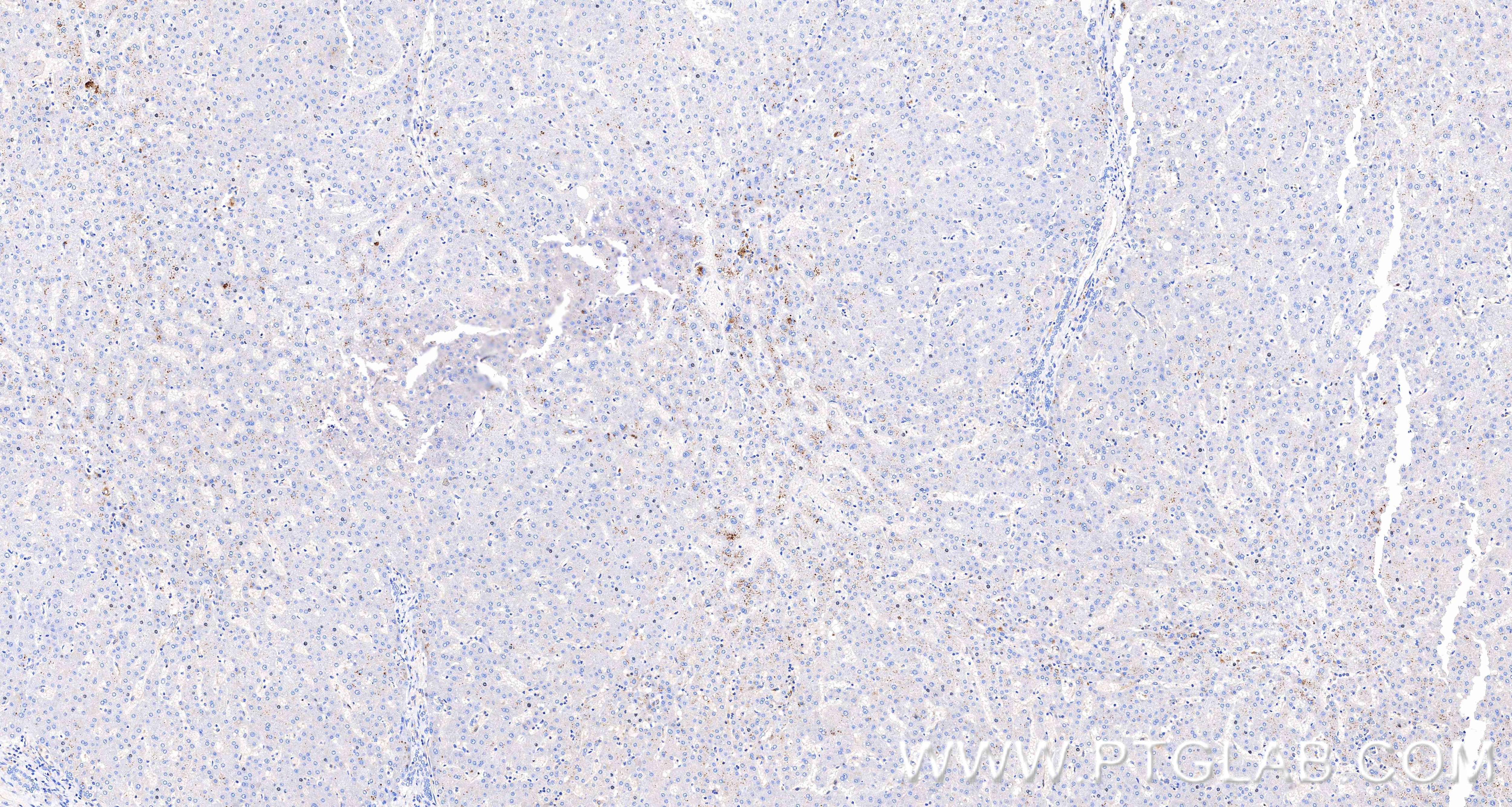 IHC staining of human liver using 98889-3-RR Immunohistochemistry (IHC) staining of human liver tissue using Anti-Human IGF1 Rabbit Recombinant Antibody (98889-3-RR)