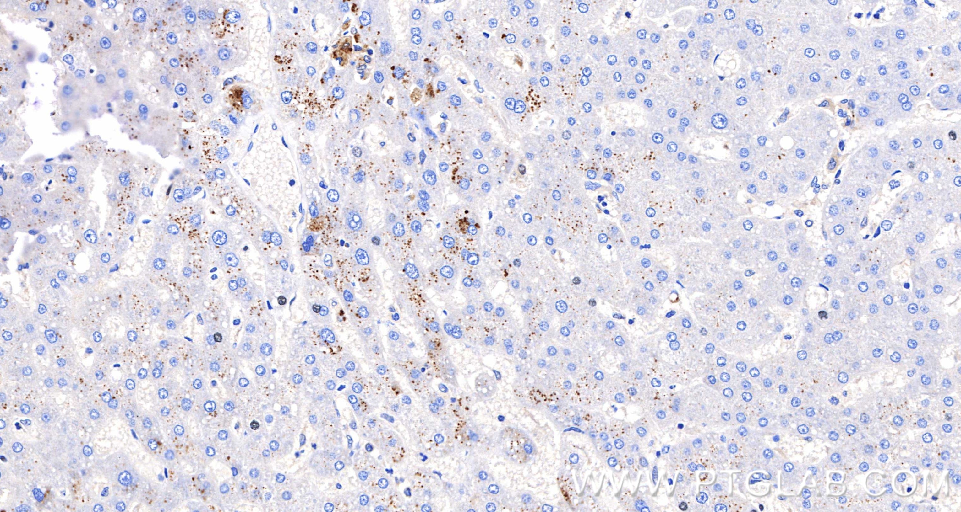 IHC staining of human liver using 98889-3-RR Immunohistochemistry (IHC) staining of human liver tissue using Anti-Human IGF1 Rabbit Recombinant Antibody (98889-3-RR)