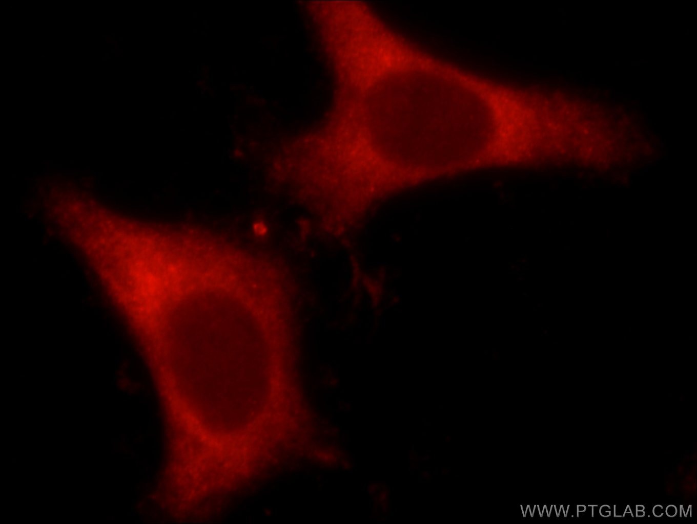 IGF1A-Specific Polyclonal antibody