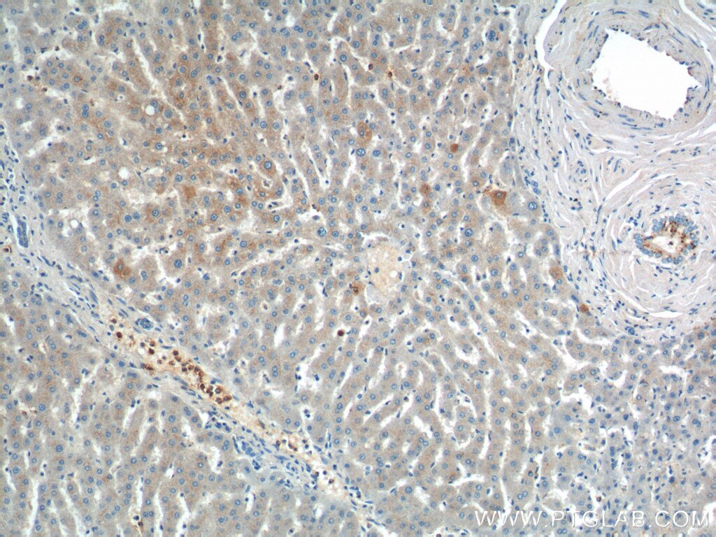 Immunohistochemistry (IHC) staining of human liver tissue using IGF1A-Specific Polyclonal antibody (20214-1-AP)
