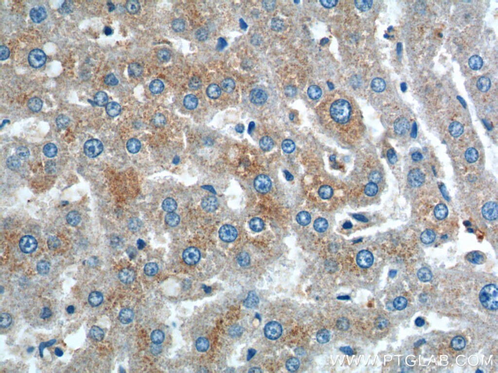 Immunohistochemistry (IHC) staining of human liver tissue using IGF1A-Specific Polyclonal antibody (20214-1-AP)