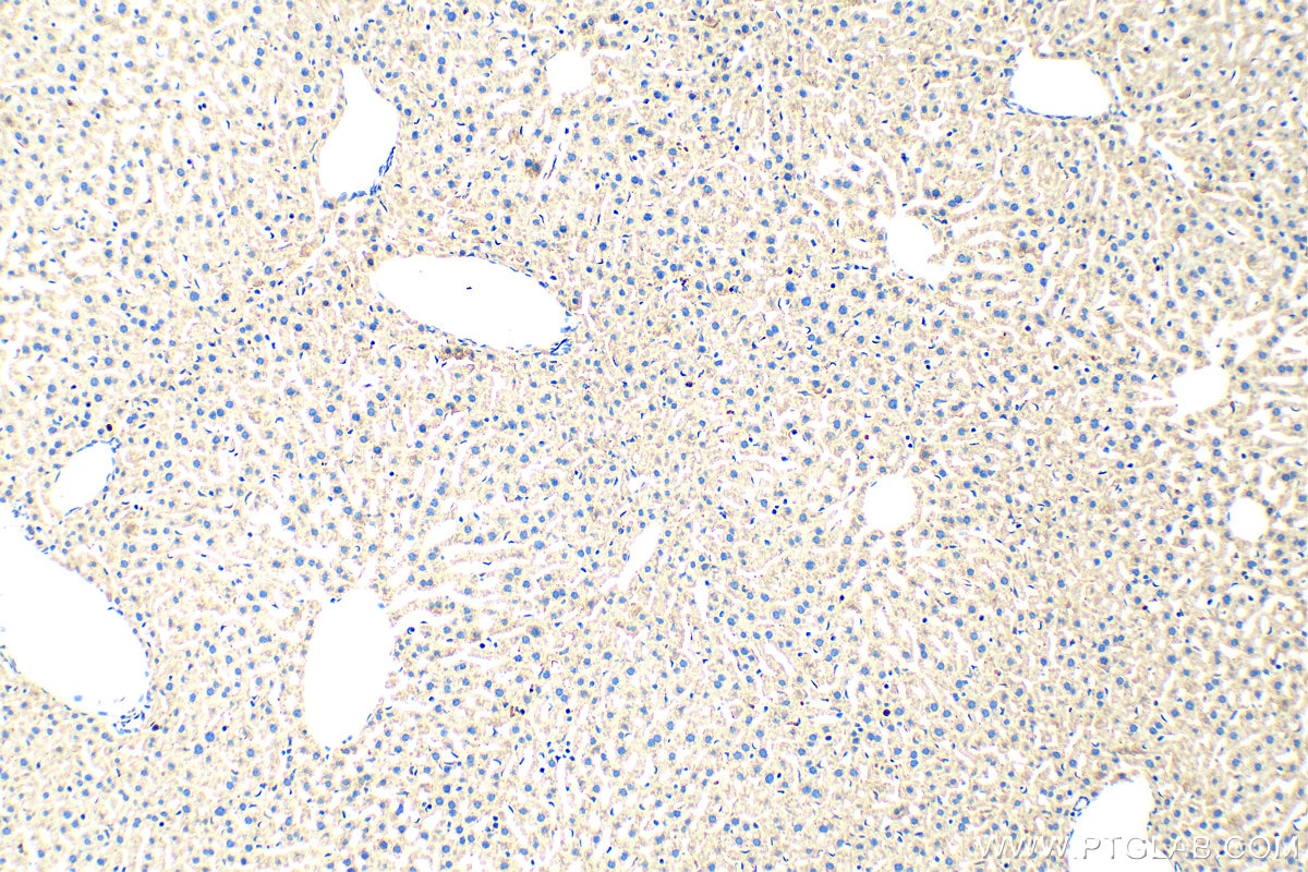 Immunohistochemistry (IHC) staining of mouse liver tissue using IGF1A-Specific Polyclonal antibody (20214-1-AP)