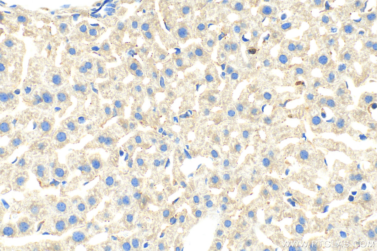 Immunohistochemistry (IHC) staining of mouse liver tissue using IGF1A-Specific Polyclonal antibody (20214-1-AP)