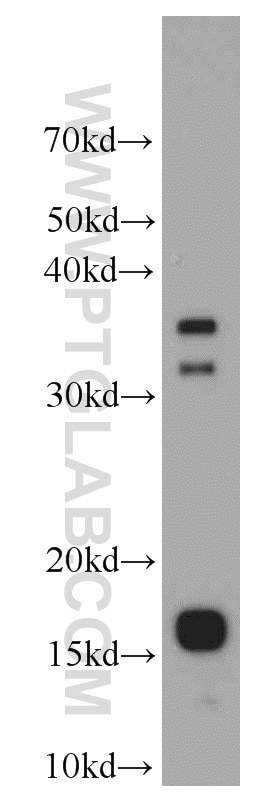 Western Blot (WB) analysis of mouse ovary tissue using IGF1A-Specific Polyclonal antibody (20214-1-AP)