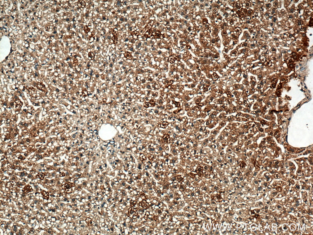 Immunohistochemistry (IHC) staining of mouse liver tissue using IGF1B-Specific Polyclonal antibody (20215-1-AP)