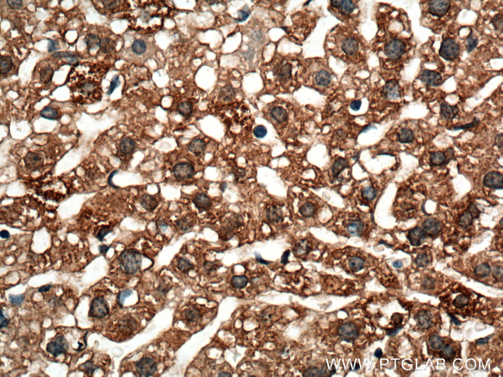 Immunohistochemistry (IHC) staining of mouse liver tissue using IGF1B-Specific Polyclonal antibody (20215-1-AP)