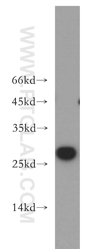 IGF1B-Specific Polyclonal antibody
