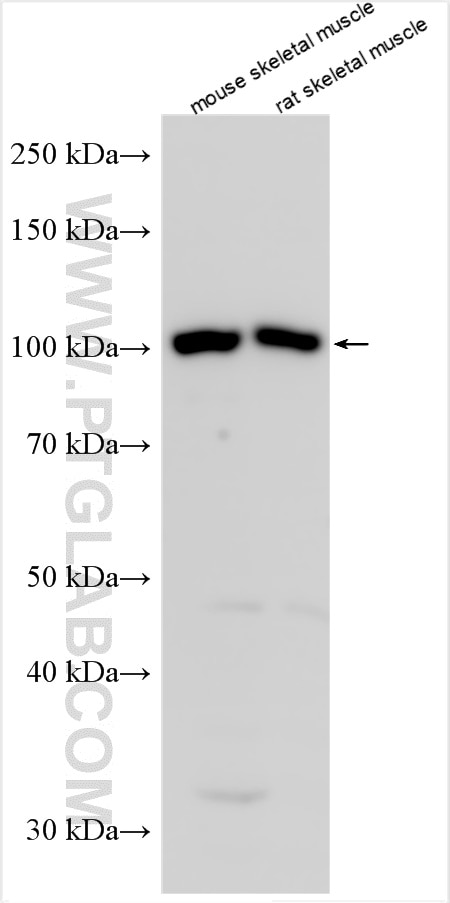 Western Blot (WB) analysis of various lysates using IGF1R Polyclonal antibody (21707-1-AP)