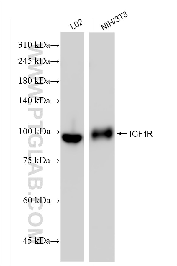 IGF1R