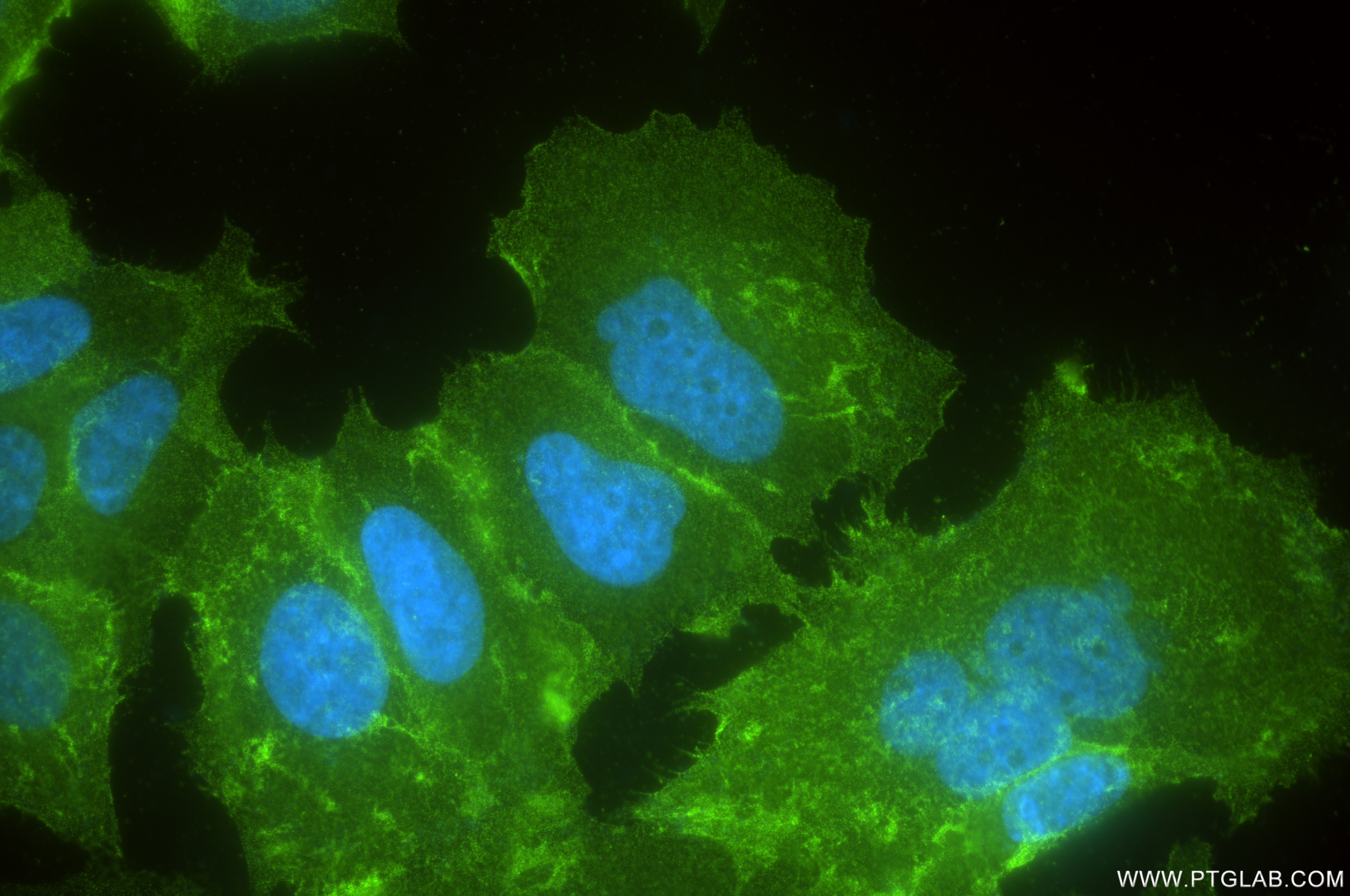 Immunofluorescence (IF) / fluorescent staining of MCF-7 cells using IGF1R Recombinant antibody (84385-3-RR)