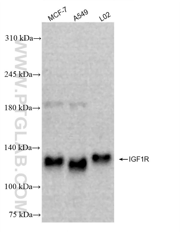 Western Blot (WB) analysis of various lysates using IGF1R Recombinant antibody (84385-3-RR)