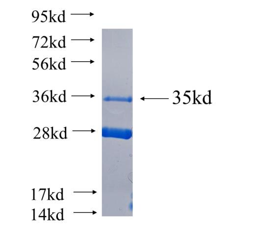 IGF1R fusion protein Ag24732 SDS-PAGE