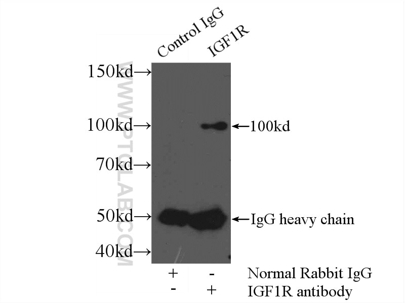 Immunoprecipitation (IP) experiment of HeLa cells using IGF1R Beta Chain Polyclonal antibody (20254-1-AP)